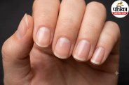 White Spots on Nails Causes,Leukonychia Symptoms and Treatment,Zinc Deficiency Nail Signs,
