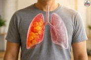 Lung Cancer