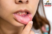 mouth ulcer vs oral cancer,oral cancer symptoms in hindi,mouth ulcer difference oral cancer,