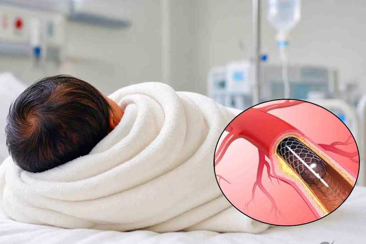 Stent inserted: बच्चे और स्टंट की प्रतिकात्मक फोटो (Photo Source - AI or freepik )
