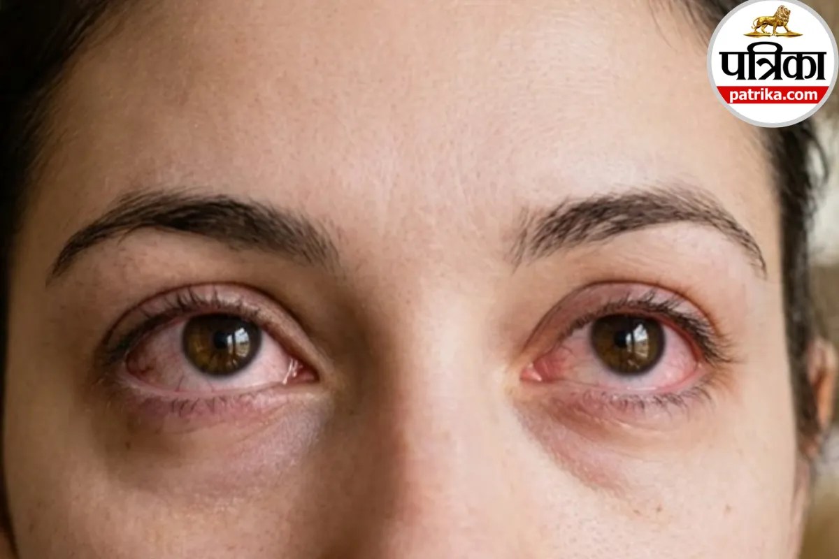 red eye symptoms,red eye causes and treatment,when to see doctor for red eye,
