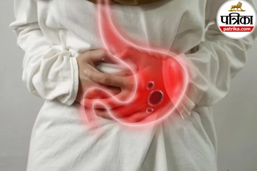 stomach ulcer symptoms,gastric ulcer causes,stomach burning pain,