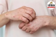 anaphylaxis symptoms and treatment,severe allergic reaction signs,sudden breathing difficulty allergy,