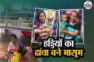 Child Malnutrition