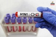 moradabad swine flu case health department alert