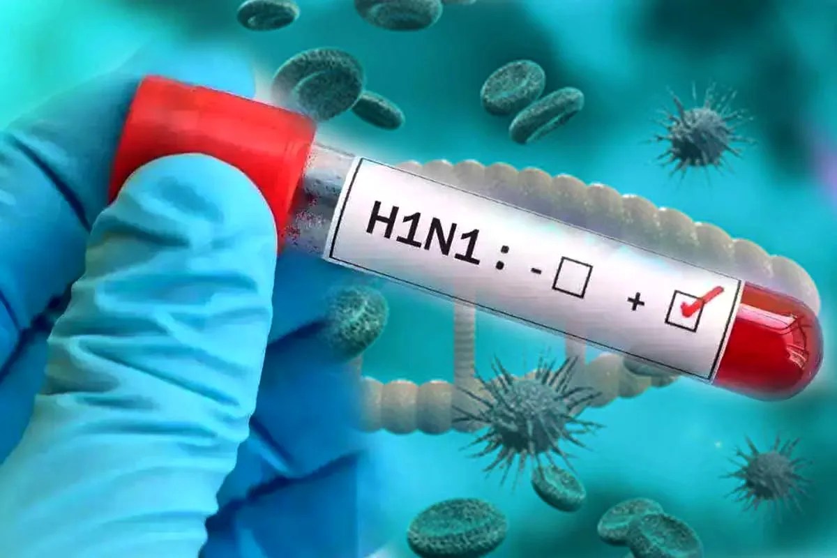 Swine Flu Cases In MP