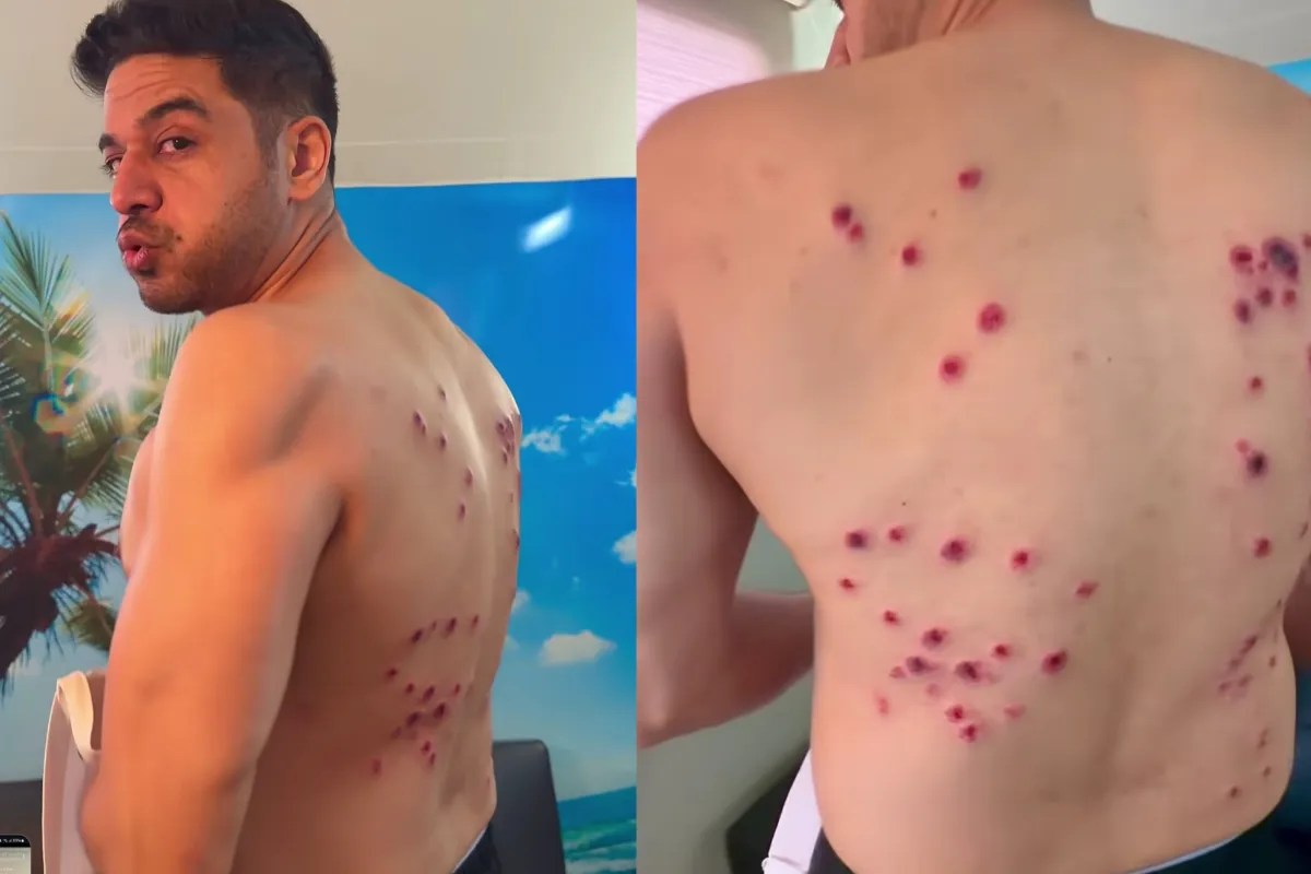 Gaurav Khanna Injury