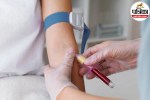 allergy skin test types,how allergy skin testing works,skin prick test for allergies,