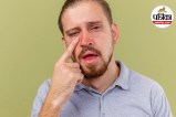 Angioedema symptoms,Facial swelling causes,Sudden lip swelling,