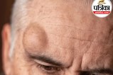 body cyst causes in Hindi, Skin cyst symptoms ,Why cyst formed repeatedly