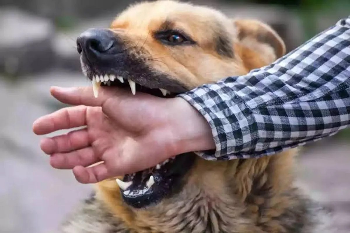 Dog bite case in Surguja