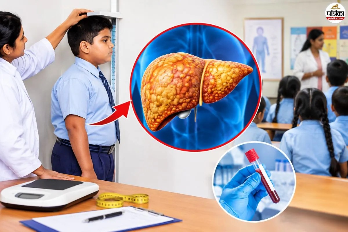 Fatty Liver Screening