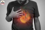 esophagus and stomach showing how aging can lead to more frequent heartburn and acid reflux