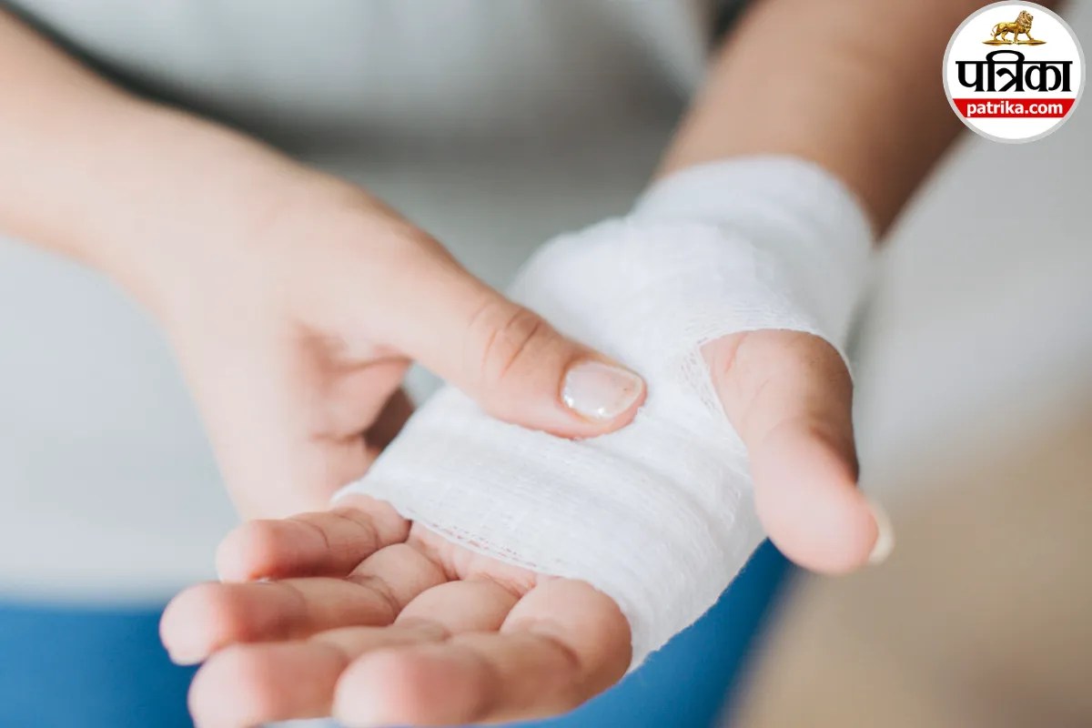 Deep cut on hand from knife or glass showing when medical attention is needed