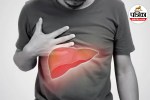 Liver hemangioma symptoms,Non cancerous liver tumor,Benign liver lesion,