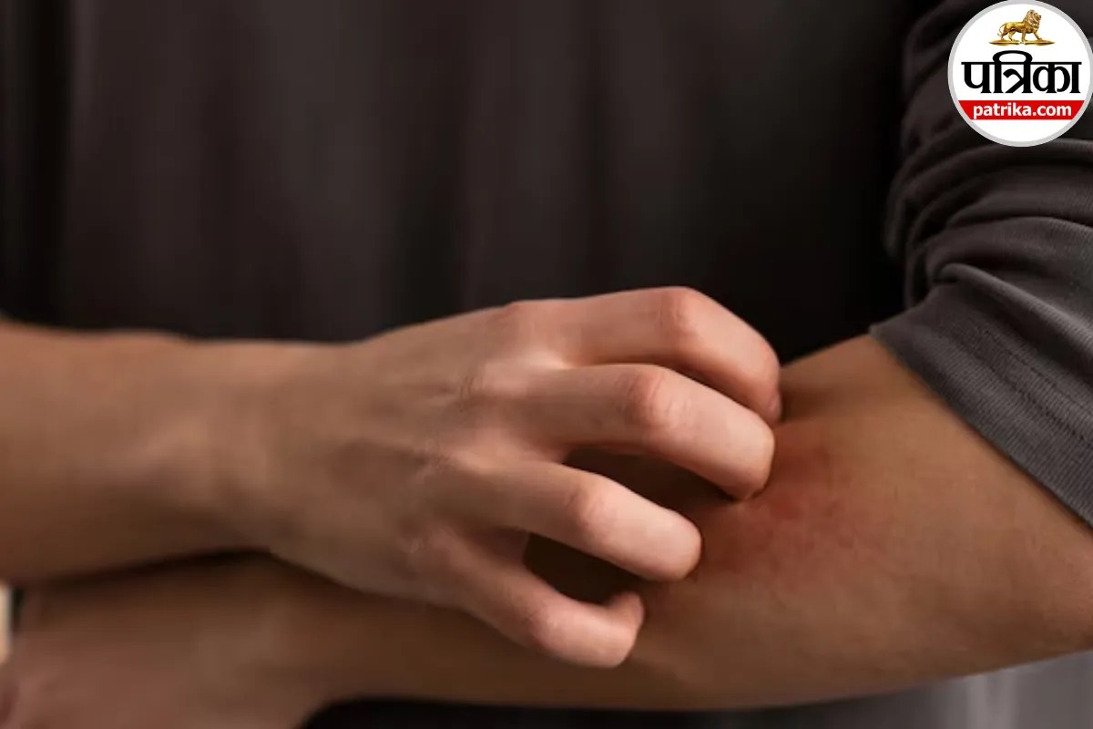 neurodermatitis symptoms and causes,itch scratch cycle neurodermatitis,thickened skin from scratching,