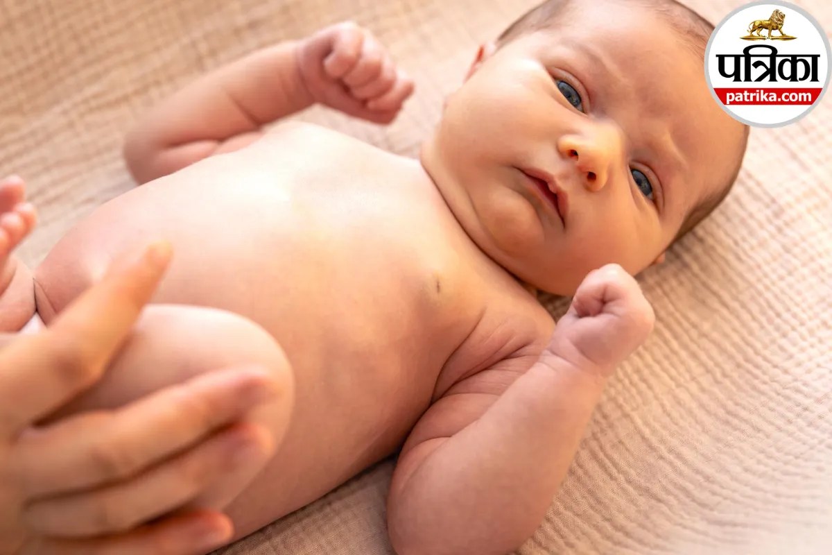 Medical illustration of a baby's lower spine and sacral dimple showing potential spinal cord connection