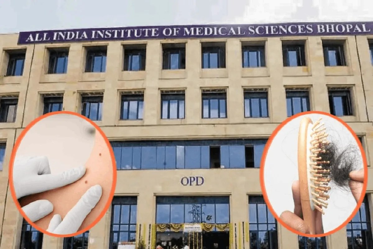 aiims bhopal skin cancer signs hair loss nail brittle changes