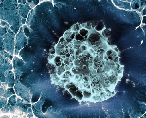 Stem Cell Therapy