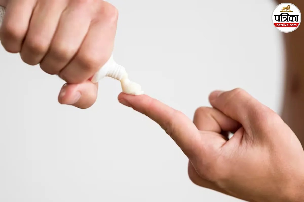 Burn First Aid, Toothpaste On Burns
