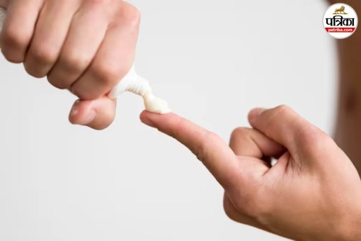 Burn First Aid, Toothpaste On Burns