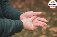 ulnar nerve compression in the cubital tunnel at the elbow causing hand numbness