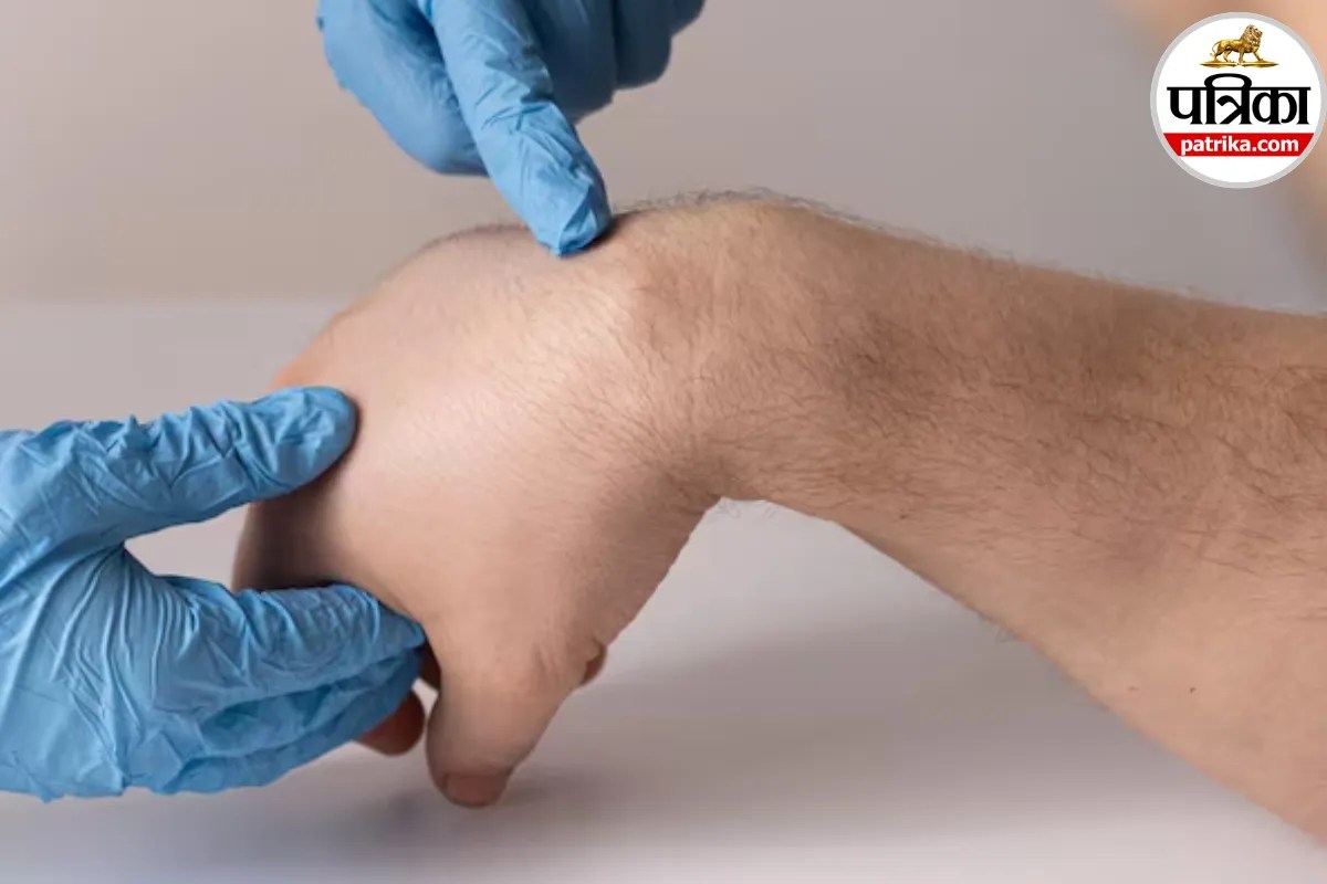 soft lump on wrist and potential symptoms of ganglion cyst