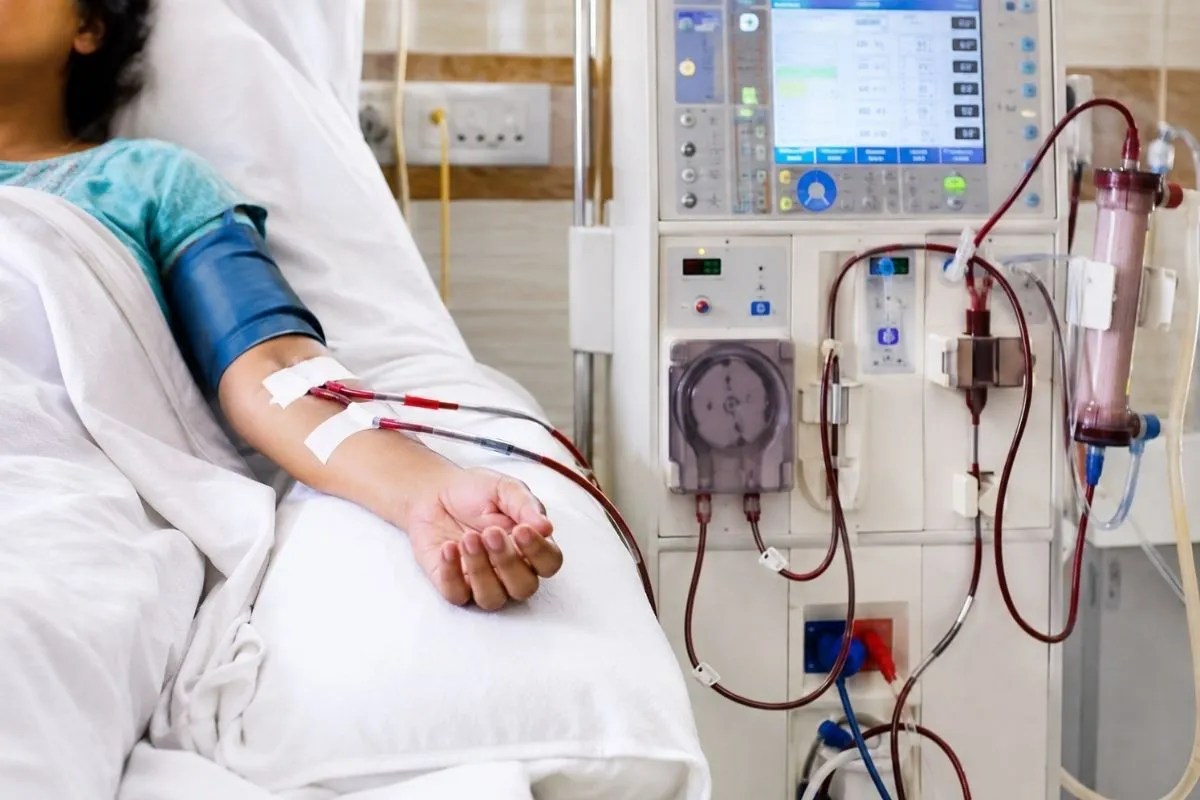 dialysis after delivery