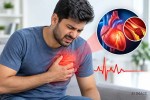 heart attack
