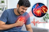 heart attack