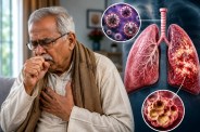 Viral Infection Pneumonia Attack