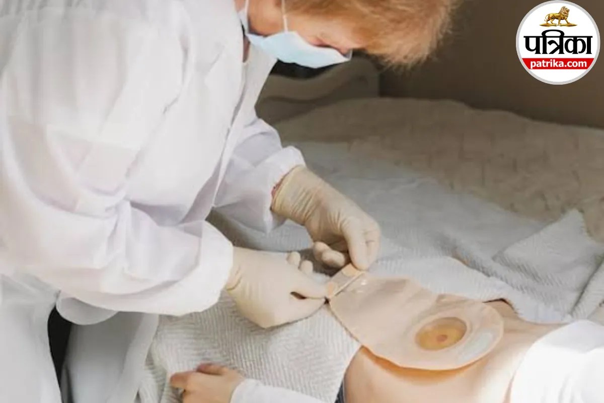 ostomy reversal surgery,colostomy reversal procedure,,stoma bag removal process,