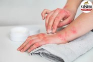 Red itchy rash and skin irritation on hand caused by contact dermatitis from jewelry or soap