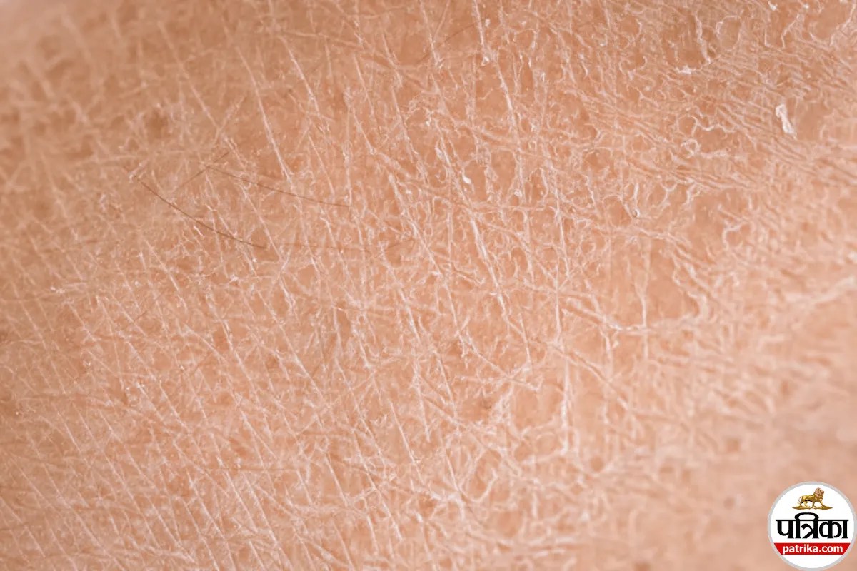 Dry Skin Care Tips