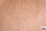 Dry Skin Care Tips