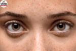 Eye First Aid