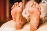 Foot Peel Mask