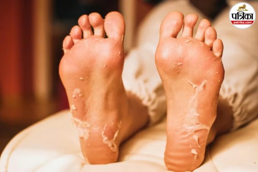 Foot Peel Mask