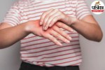 inflammation symptoms and health care to a patient