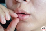 Lip Care Tips