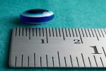 Pearl Stuck in 4-Year-Old Girl's Airway for 22 Days; Removed via Bronchoscopy