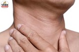 Neck Wrinkles