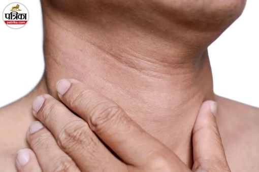 Neck Wrinkles
