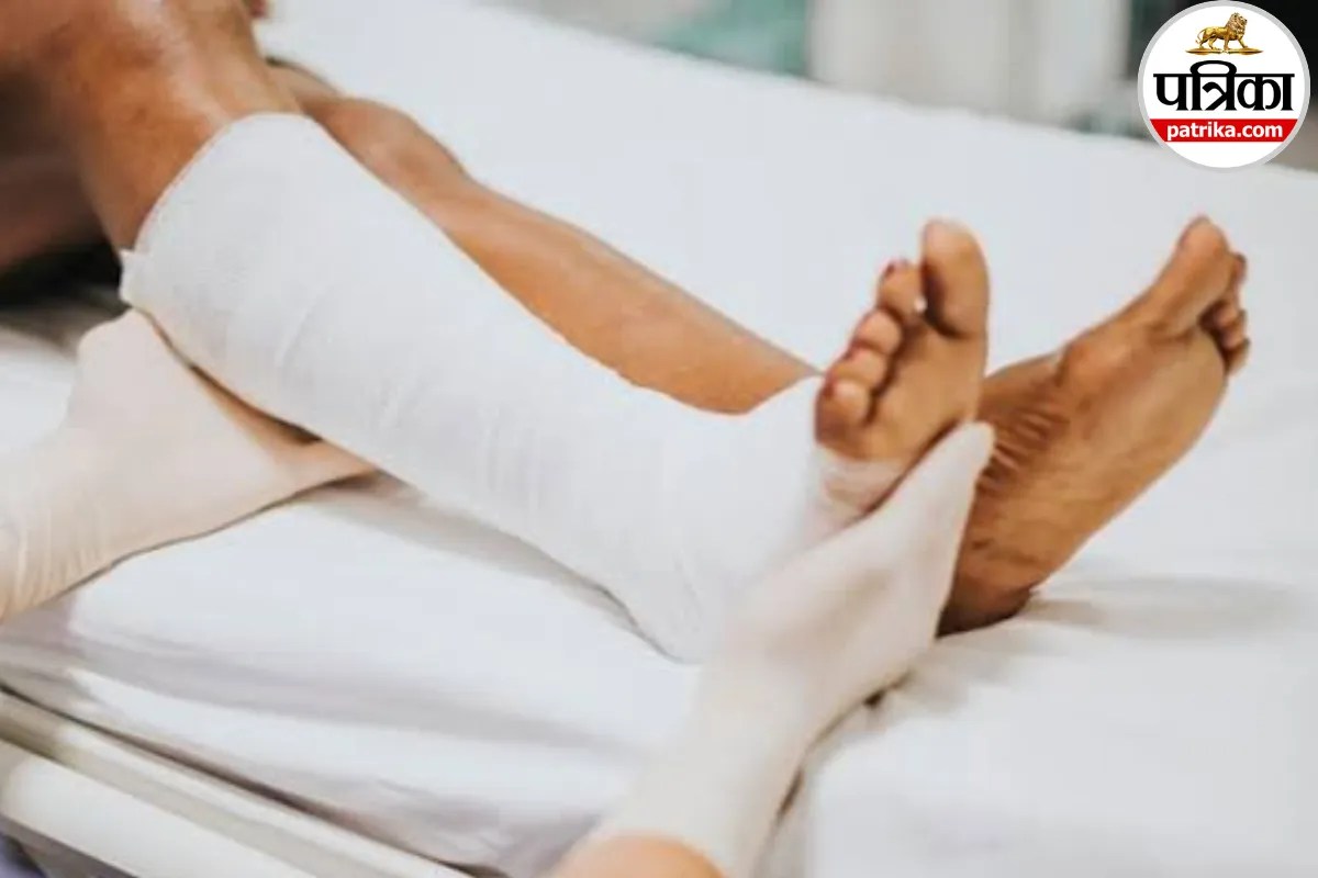 image showing an oblique fracture in a human bone with diagnosis and treatment details