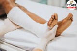 image showing an oblique fracture in a human bone with diagnosis and treatment details