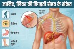 Signs of liver disease