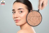 Winter Skin Care, Dry Skin Care
