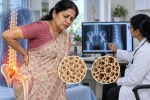 Women at risk of osteoporosis