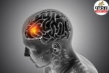 World Stroke Day brain stroke symptoms FAST formula and golden hour importance in Hindi