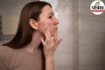Dry and scaly skin on hands and arms showing symptoms of xerosis during winter season